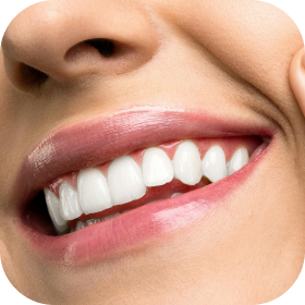 Serviço clareamento dental